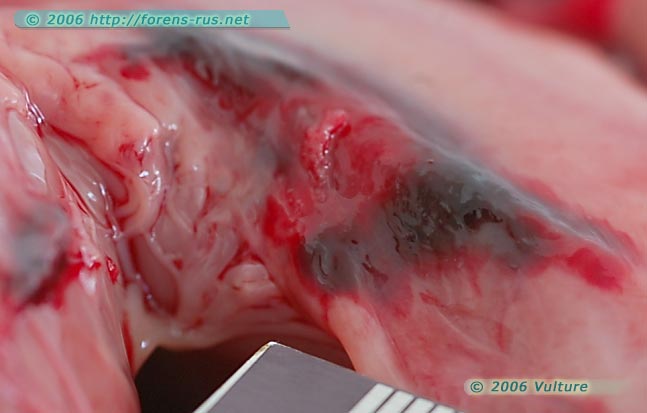 gallery_9_183_11314.jpg