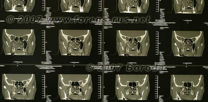 gallery_9_209_36659.jpg