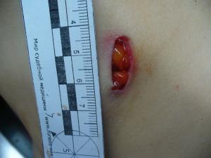 post-84-1200292034_thumb.jpg
