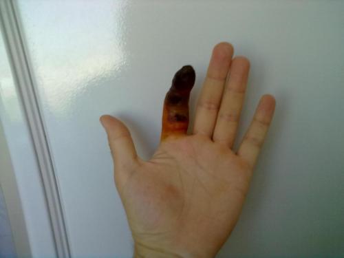 post-2956-0-10996700-1325607731_thumb.jpg