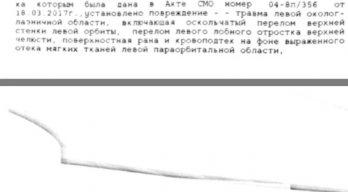 post-8679-0-53047900-1515661753_thumb.png