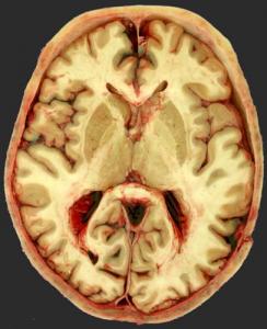 Fig5.jpg