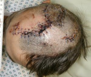 skin_head_wounds.jpg