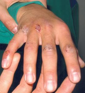 skin_hand.jpg