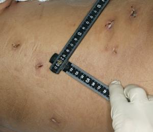 skin_abdomen_wounds.jpg