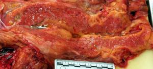 Pancreas1.jpg