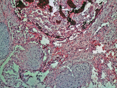 post-145-1300957403_thumb.png