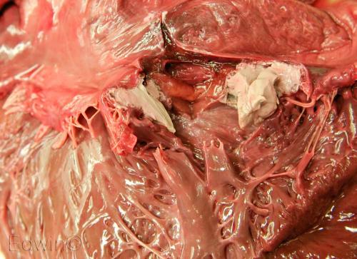 abscess.jpg