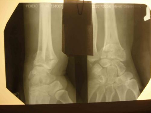 post-7-1300798693_thumb.jpg