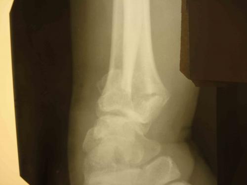post-7-1300798706_thumb.jpg