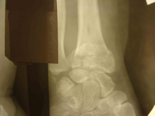 post-7-1300798712_thumb.jpg
