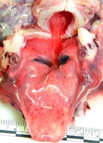 epiglottis.jpg