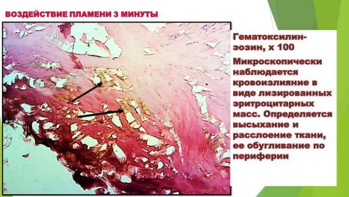 Слайд10.JPG