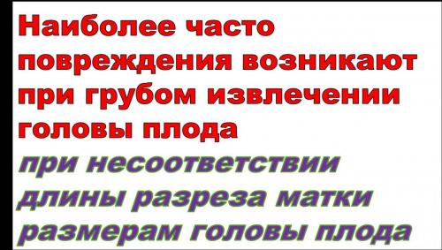 Рисунок11.jpg
