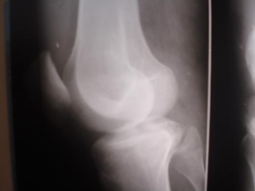 post-2399-1304607979_thumb.jpg