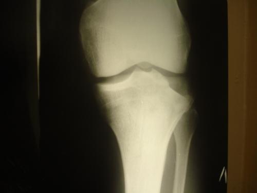 post-2399-1304608332_thumb.jpg