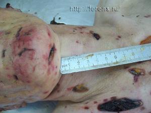 post-15-1275475291_thumb.jpg