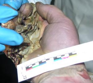 post-313-1276419876_thumb.jpg