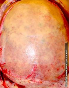 post-2-1216699044_thumb.jpg