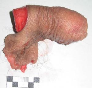 penis.jpg