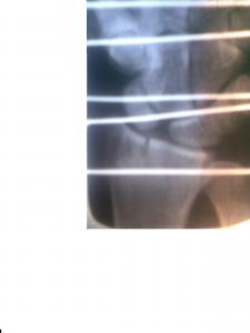 post-270-1278077787_thumb.jpg
