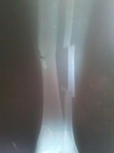 post-10542-0-21668500-1532808272_thumb.jpg