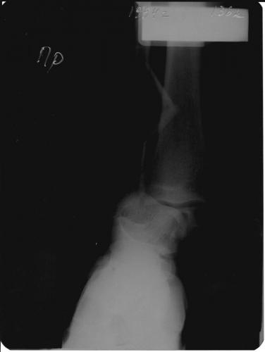 post-10561-0-74649600-1533066708_thumb.jpg