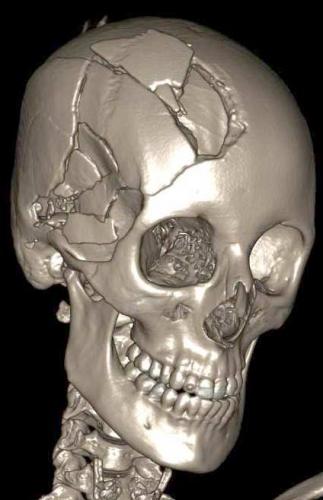 dicom1.jpg