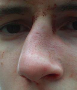 post-227-1225471153_thumb.jpg