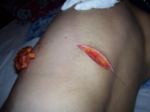 post-1192-1288449871_thumb.jpg