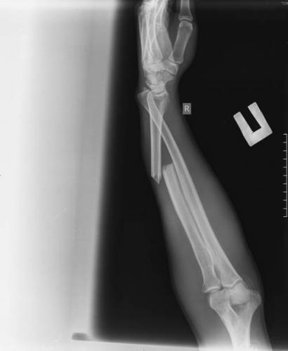 post-1575-0-10775800-1510674750_thumb.jpg