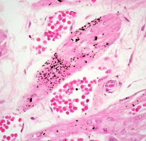 Formalin_Pigment.jpg