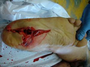 post-1192-1259966015_thumb.jpg