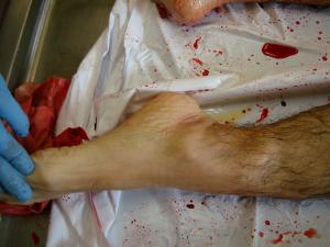 post-1192-1259966026_thumb.jpg