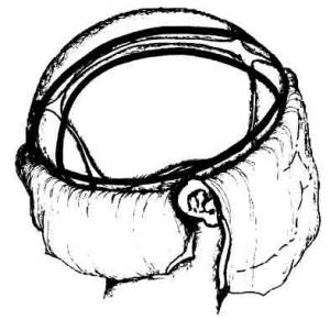 korbhenkelschnitt.jpg