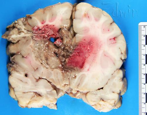 hirntu2.jpg