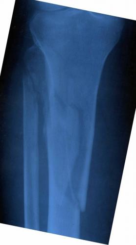 post-4706-0-10823300-1512985846_thumb.jpg