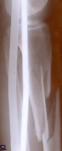 post-4706-0-11553900-1512985832_thumb.jpg
