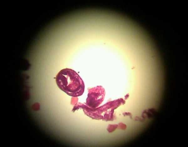 Протосколексы Echinococcus granulosus и их фрагменты