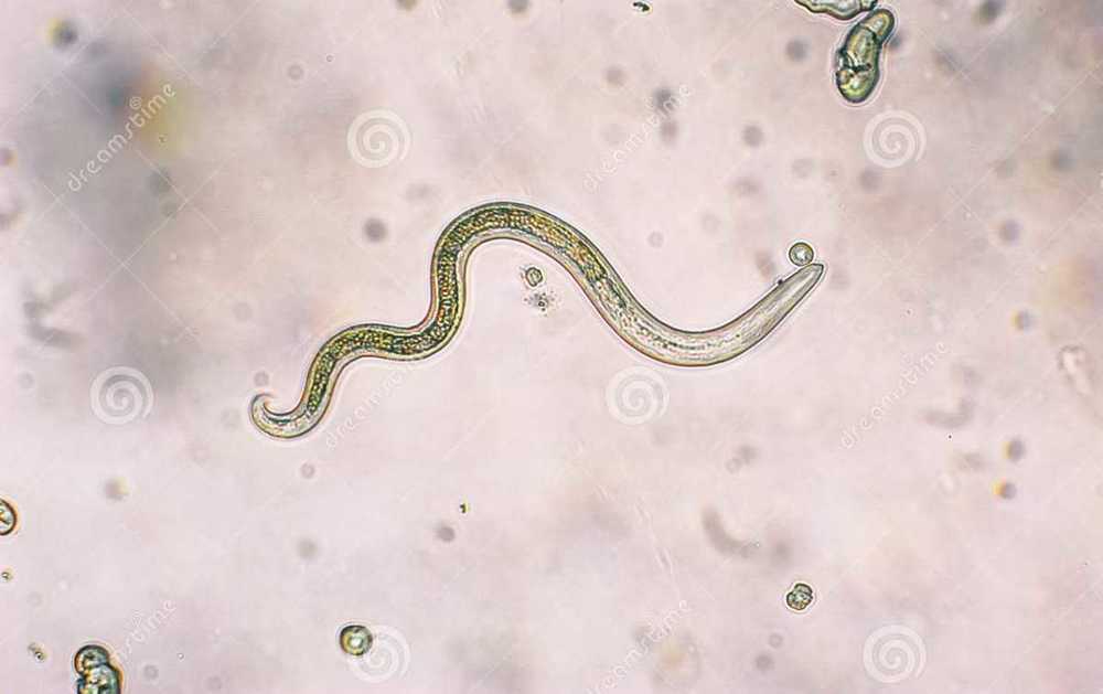toxokara canis.JPG