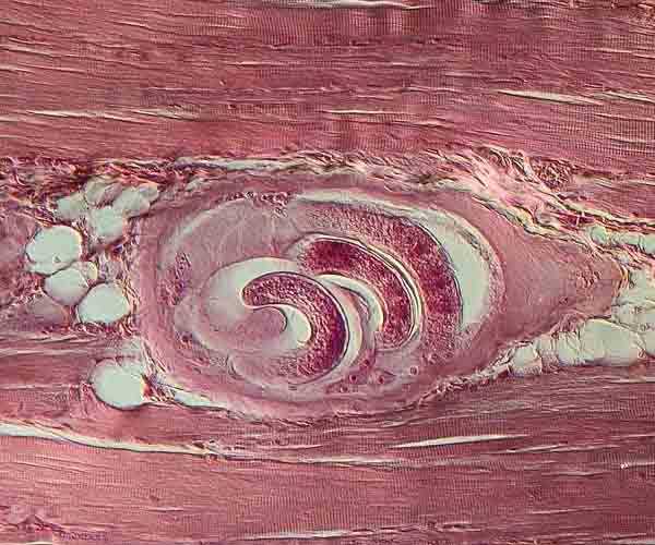 trihinella-v-myshcah.jpg.f60d2e47bacf6edc083a4a16723b737a.jpg