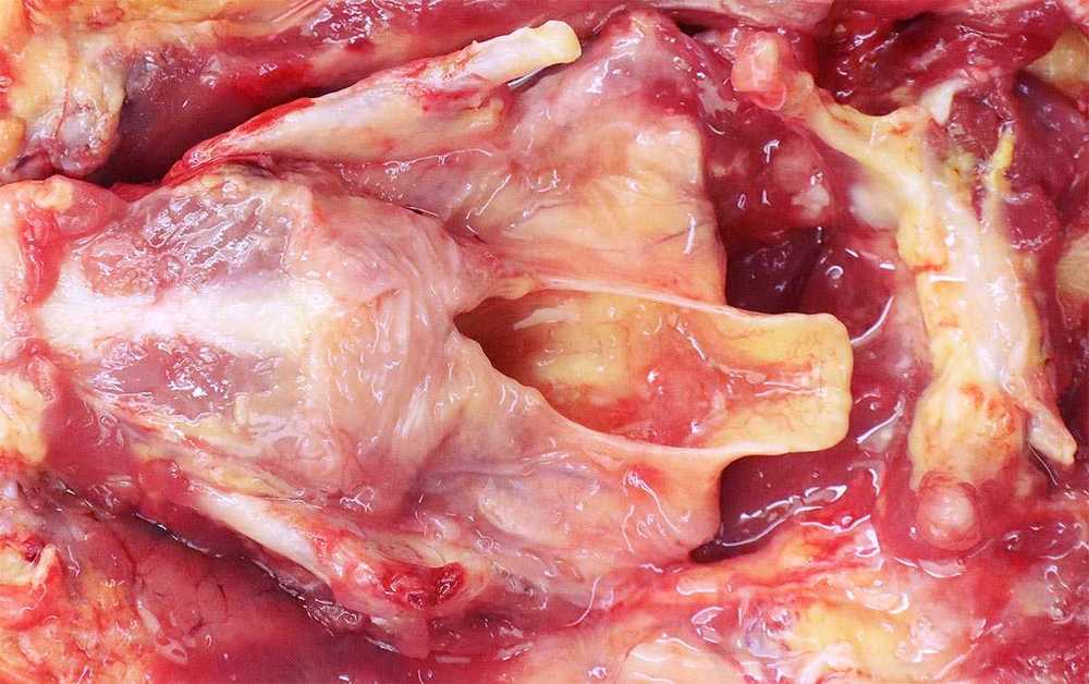 thyroid2.jpg