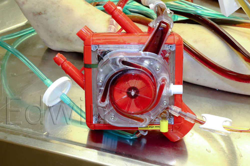ECMO2.jpg