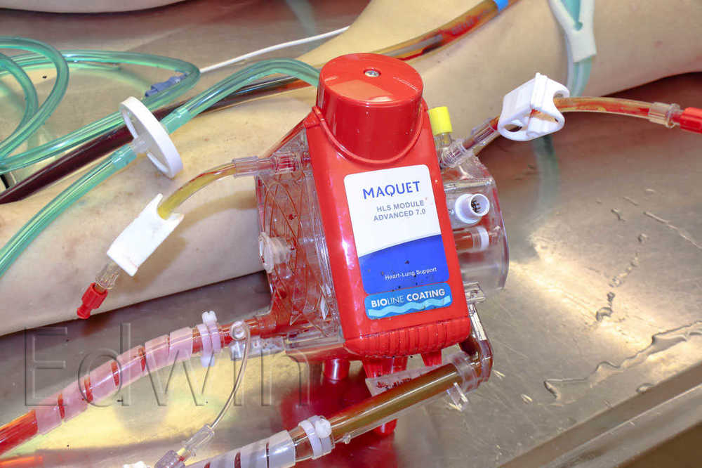 ECMO3.jpg