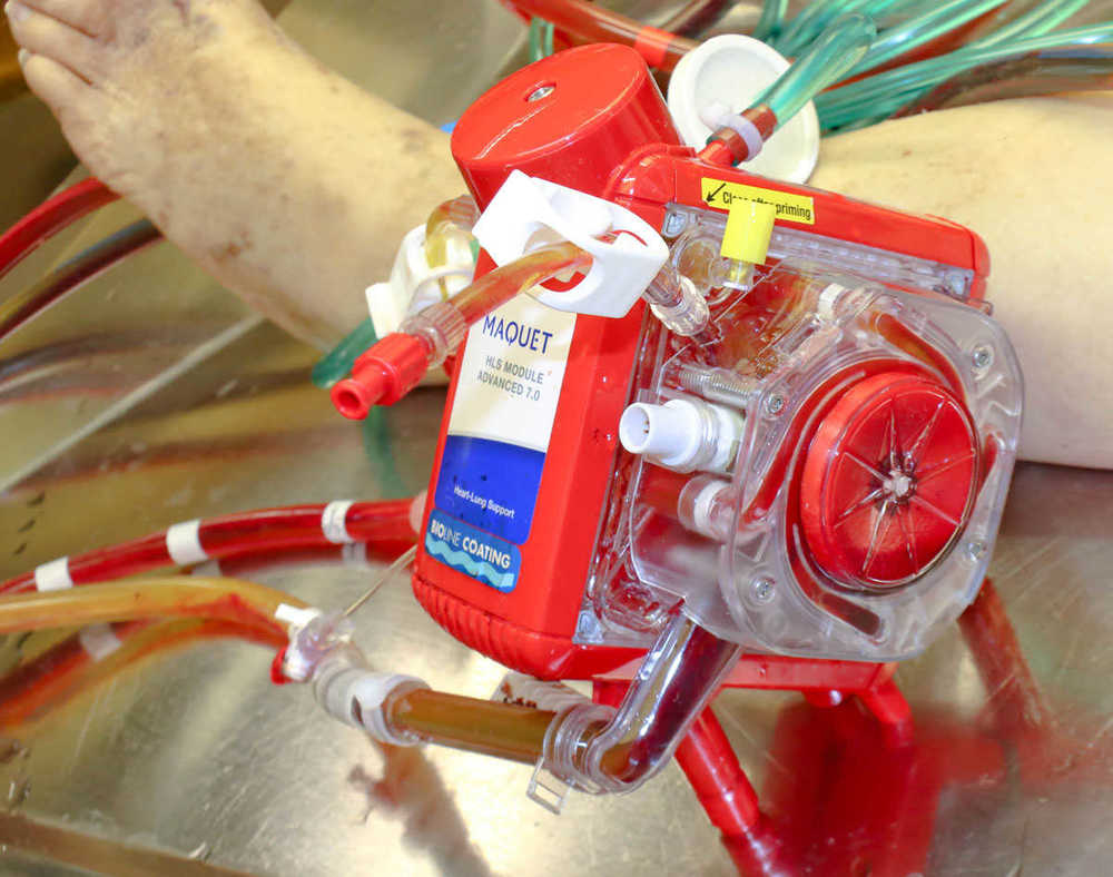 ECMO4.jpg