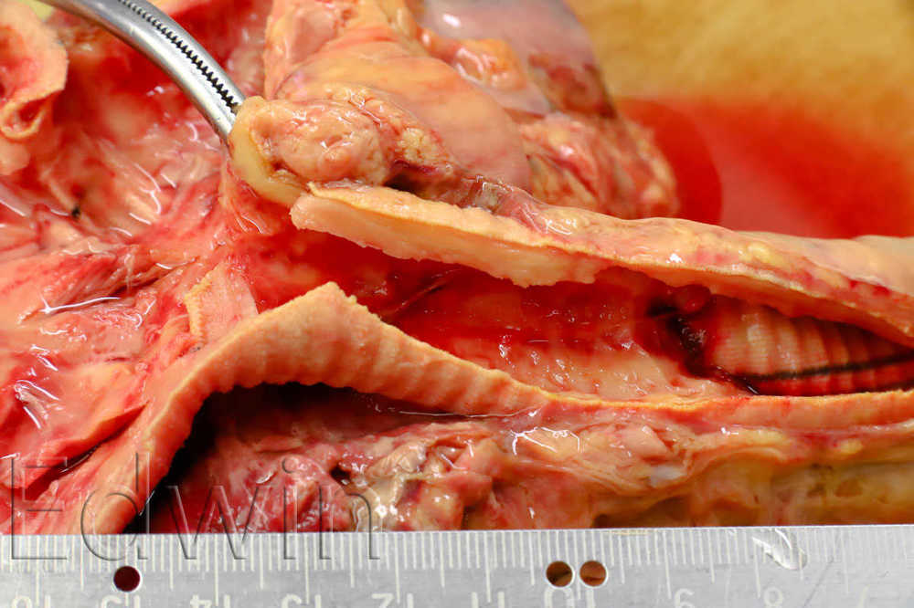 ECMO5.jpg
