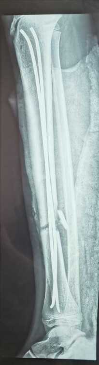 IMG_20200616_101836.jpg