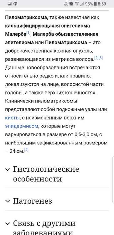 Screenshot_20210404-085948_Samsung Internet.jpg