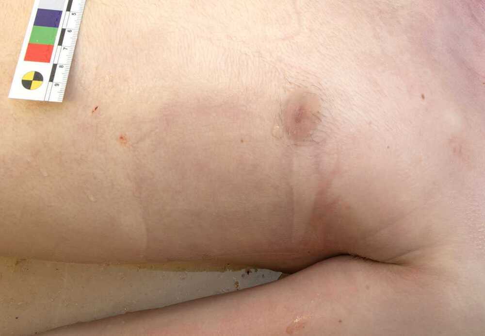 defibrillator2.jpg