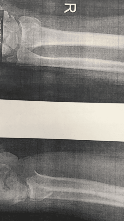 40732843-7BCD-40DA-944A-077E36E14CB5.png